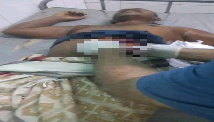 شاهد | جريمة مروعة تهز الشارع اليمني : طُرد من المنزل لرفضه شراء "ثلج".. فعاد ليطعن والده بالخنجر | تفاصيلها