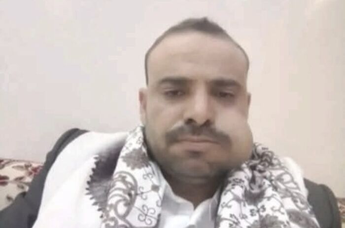 اشعل مواقع التواصل.. اليمنيون يتفاعلون مع فيديو انتحار امرأة في صنعاء بطريقة مروعة.. شاهد