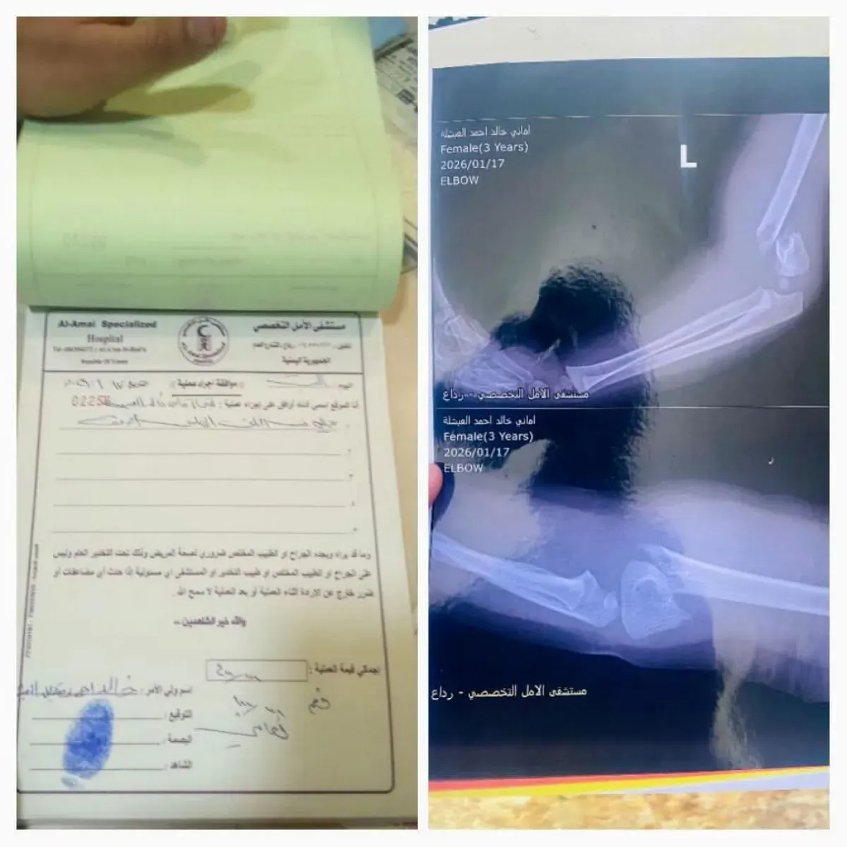 وفاة فتاة في رداع إثر مضاعفات عملية جراحية بسيطة واتهامات بالإهمال الطبي