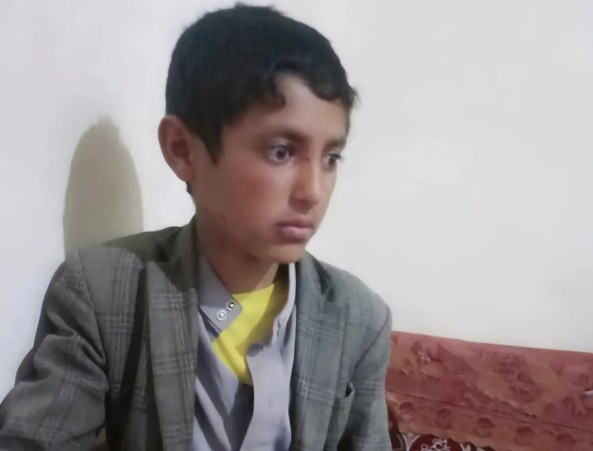 في ‏عمران.. قيادي حوثي يحتجز طفلاً في بني صريم دون تهمة رغم تعرضه لاعتداء سابق | اسماء وتفاصيل