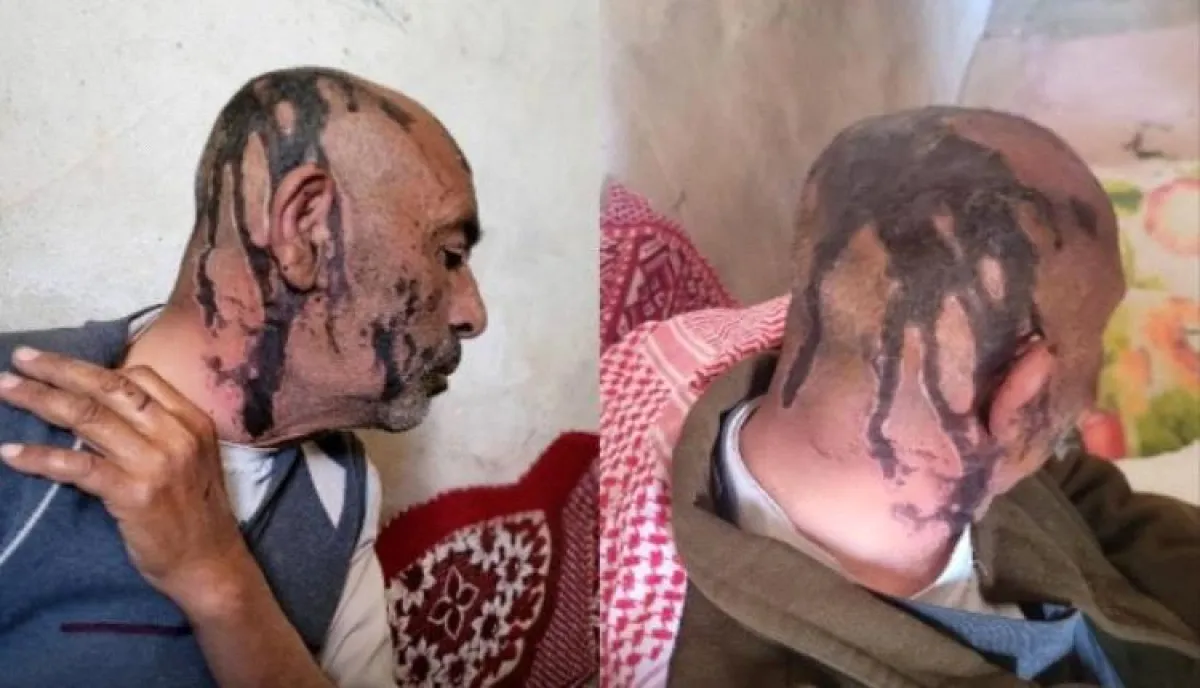 شاهد .. أب يمني يتعرض للضرب المبرح من قبل أبنائه المنخرطين مع الحوثي | صورة وتفاصيل