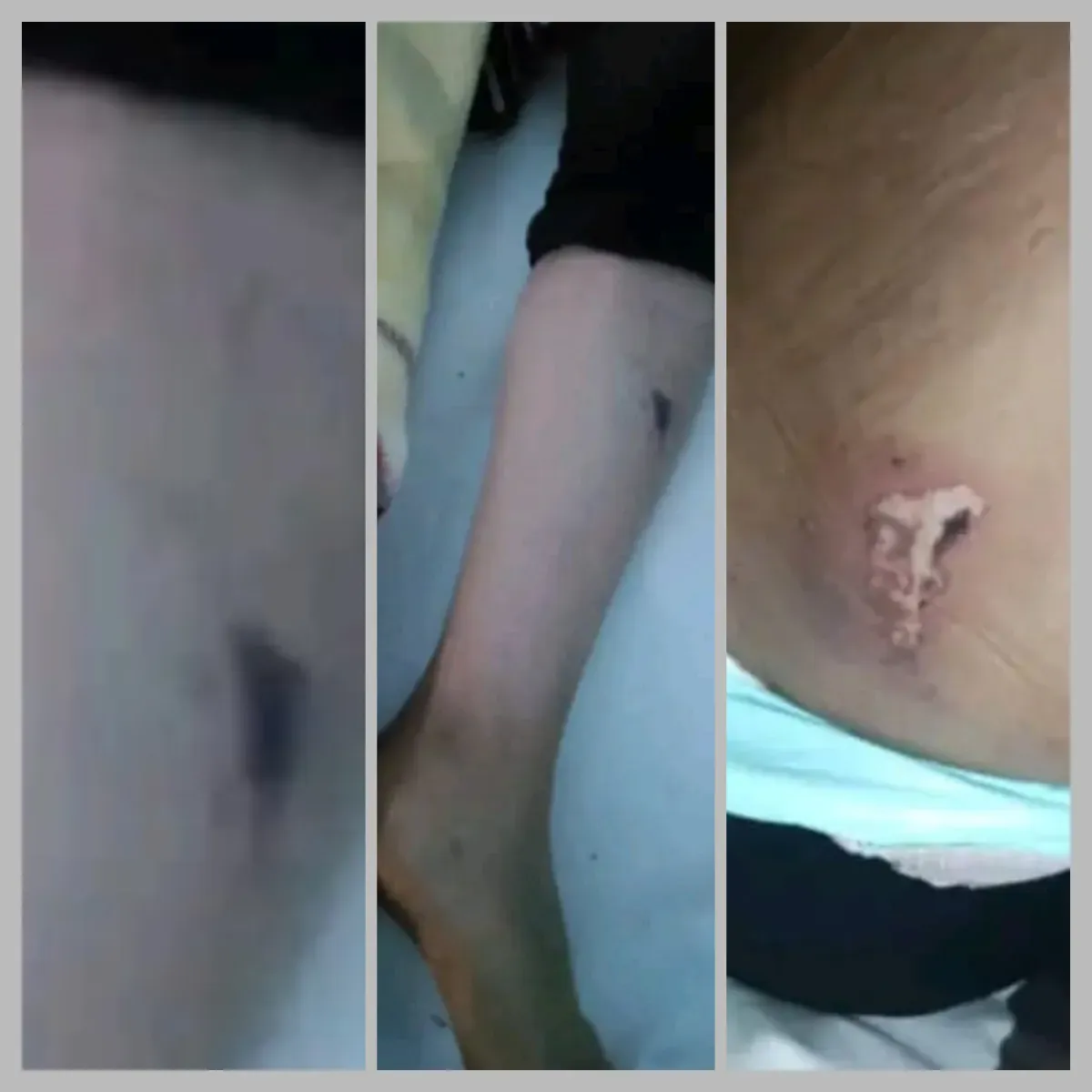 العثور على طفلة مفقودة في تعز بعد يومين وسط ظروف غامضة