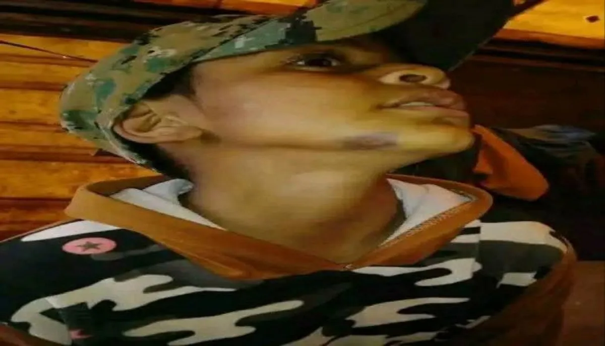 موجة غضب واستنكار واسعة | اعتداء صادم في صنعاء .. مسلح يهاجم طفلا يتيما ثم يدهس والده أمام المارة