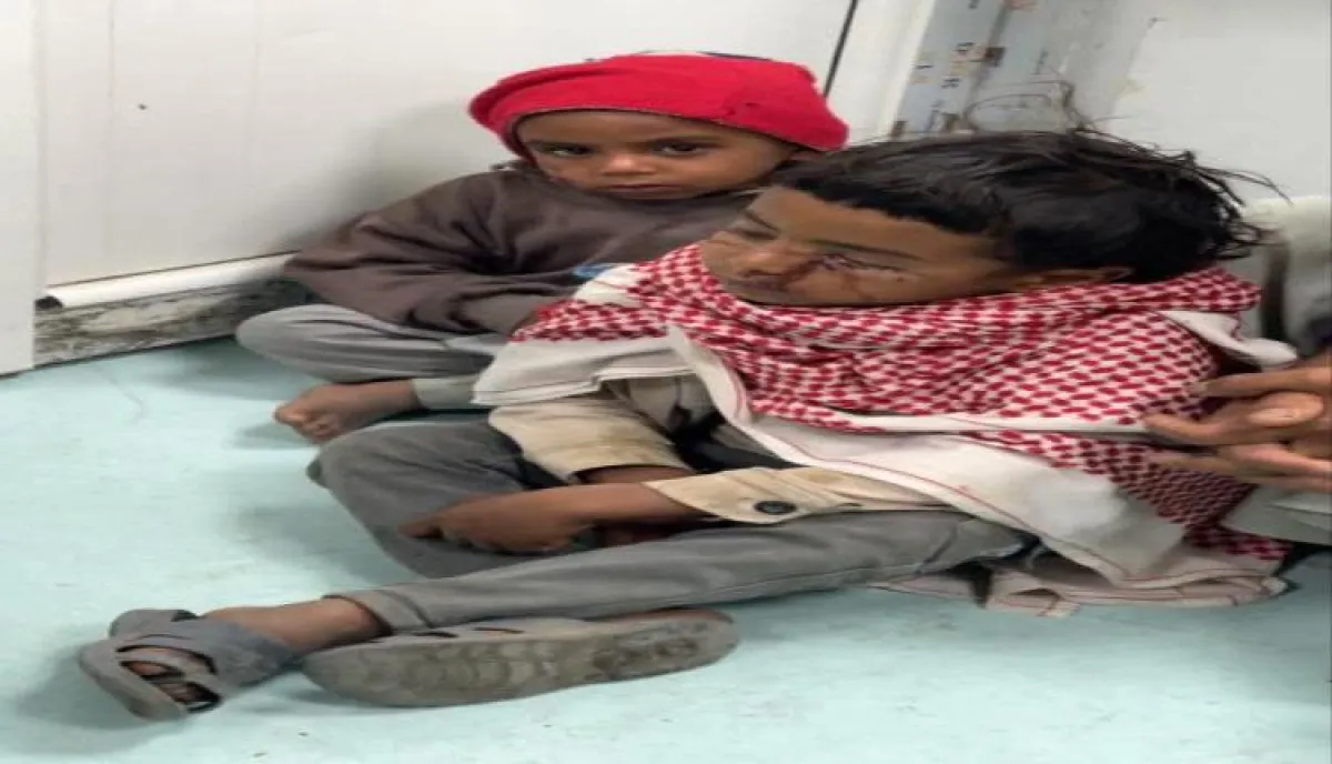 في صنعاء.. هجوم كلاب ضالة يُصيب طفلين وتحذير طبي خطير | تفاصيله