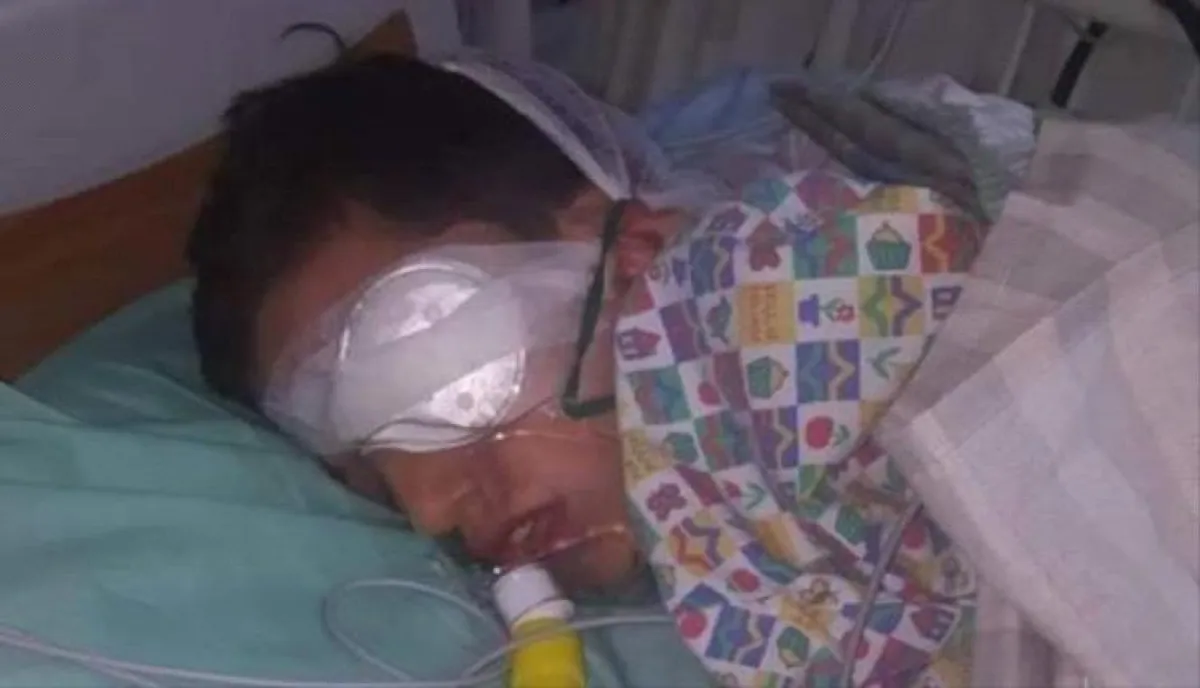 "تجارة الموت" في صنعاء.. ألعاب نارية "شديدة الانفجار" برعاية حوثية تحول العيد إلى مأتم وتغرق المستشفيات بالجرحى