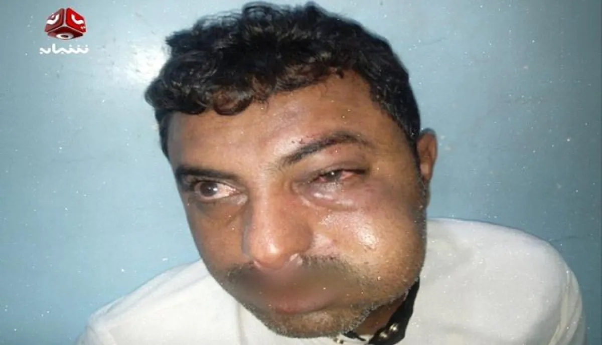 في الحديدة.. قيادي حوثي يعتدي على محامٍ بزبيد | اسماء وتفاصيل