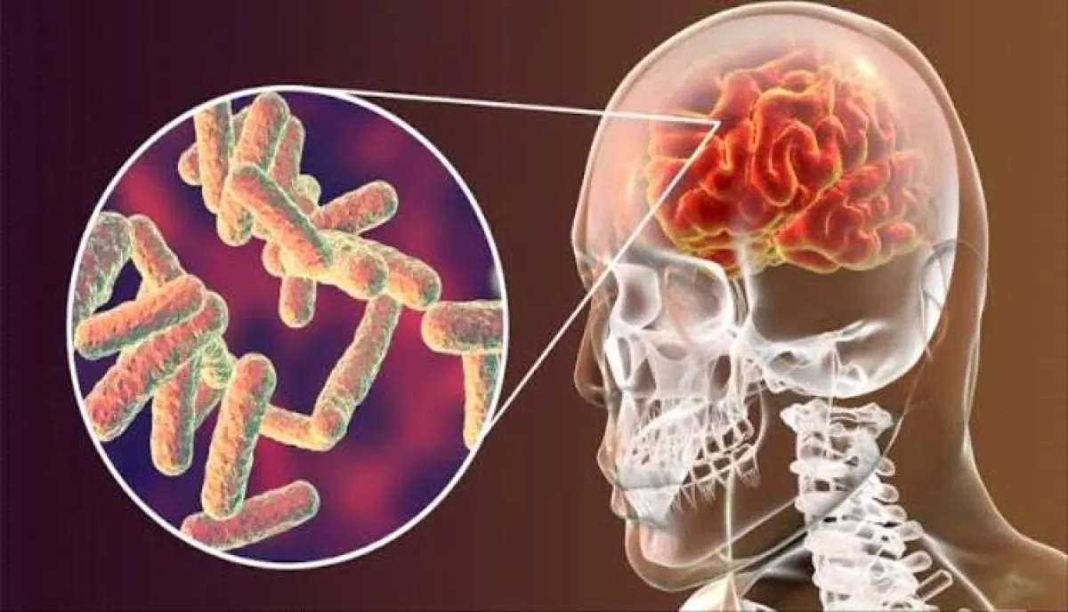 من صنعاء.. تحذير طبي عاجل يكشف أخطر مؤشرات الحمى الشوكية واعراضه قاتلة