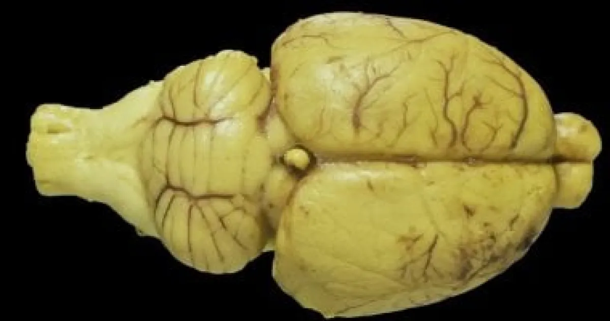 خلايا عصبية حية تنفذ مهام ذكاء اصطناعي في تجربة ثورية