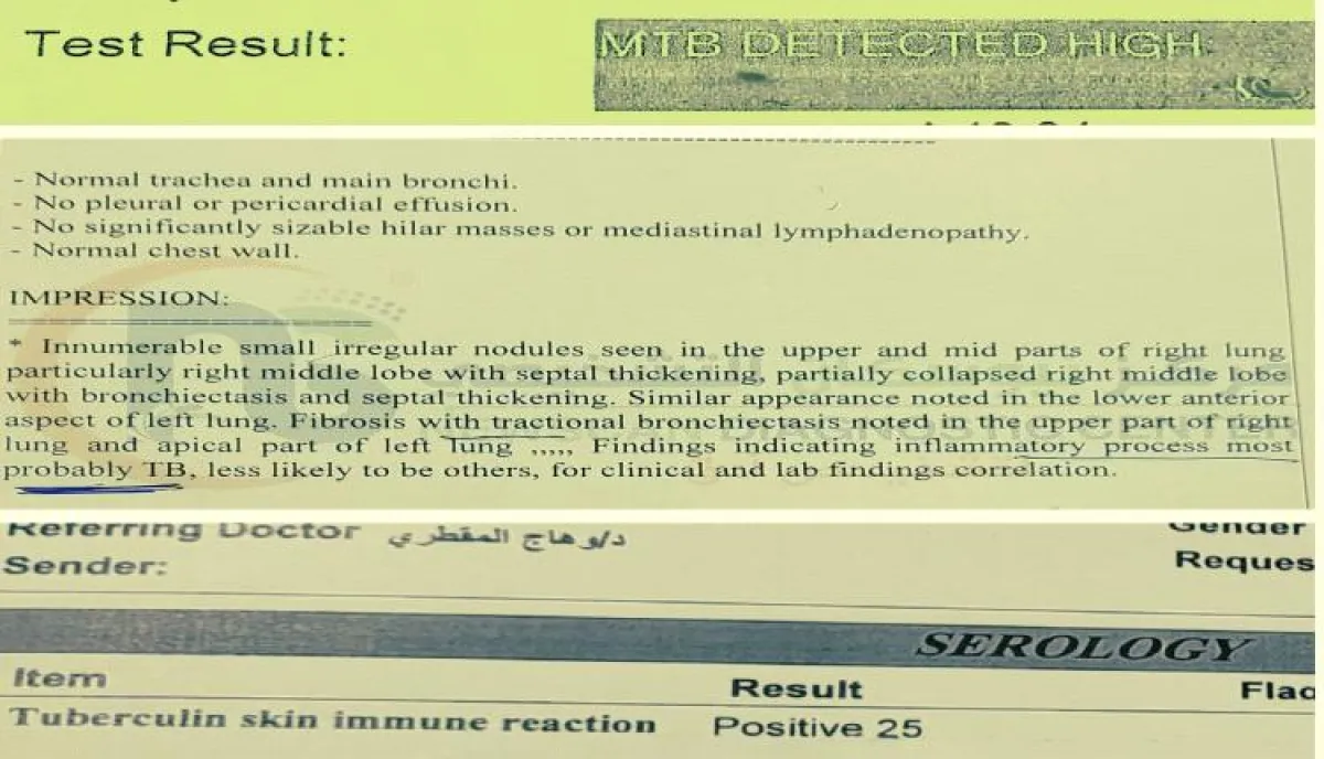"فخ التيفود" في صنعاء.. طبيب يُنقذ ستينية من موت محقق ويُعري هشاشة التشخيص الطبي