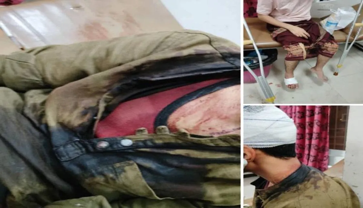 بلطجة ومناطقية في تعز: اعتداء جماعي دامي يستهدف طلاباً من أبناء المخا وتواطؤ أمني يثير غضباً عارماً