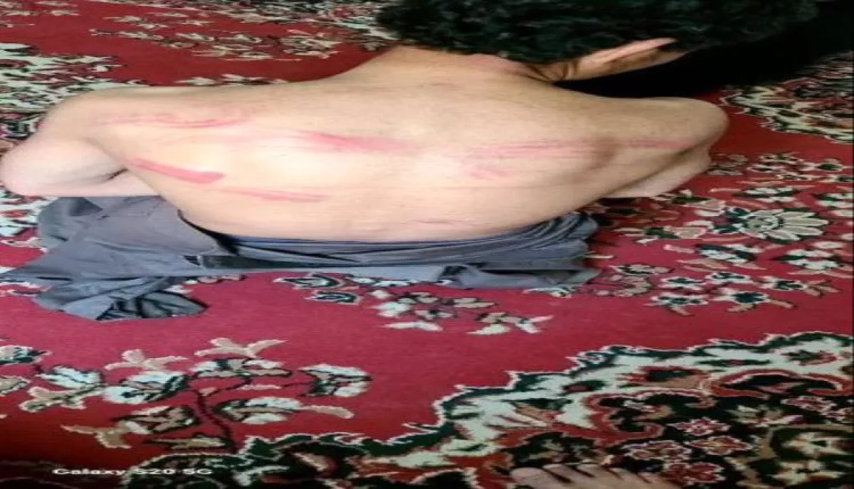 بالصور.. وحشية حوثية تدمي صعدة: قيادي بارز يعذب طفلاً في الـ14 من عمره داخل سجن سري | شاهد