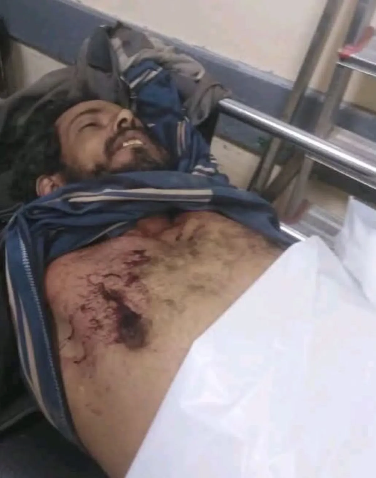 شاهد | استباحة لدماء الكادحين: قيادي حوثي يصفي عاملاً من تعز في صعدة لمطالبته بأجرة "سمكرة" سيارته | صورة وتفاصيل