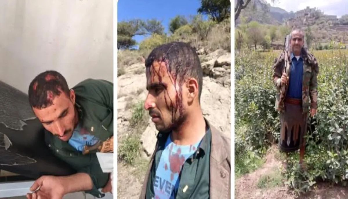 بلطجة وحشية في إب.. أقارب يسلبون "لحوم الفقراء" ويسحلون سائقاً أثناء توزيعه صدقة العيد