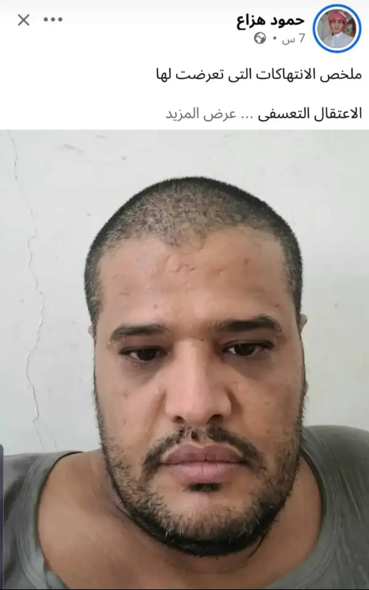 شاهد | صحفي يكشف عن انتهاكات قال إنه تعرض لها في سجون حزب الإصلاح بمأرب | اسماء وتفاصيل