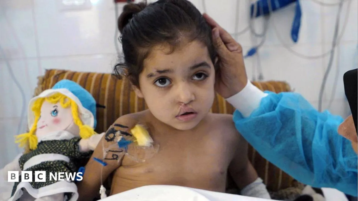 طفلة بغزة تخضع لأكثر من 20 جراحة إثر إصابتها بضربة جوية