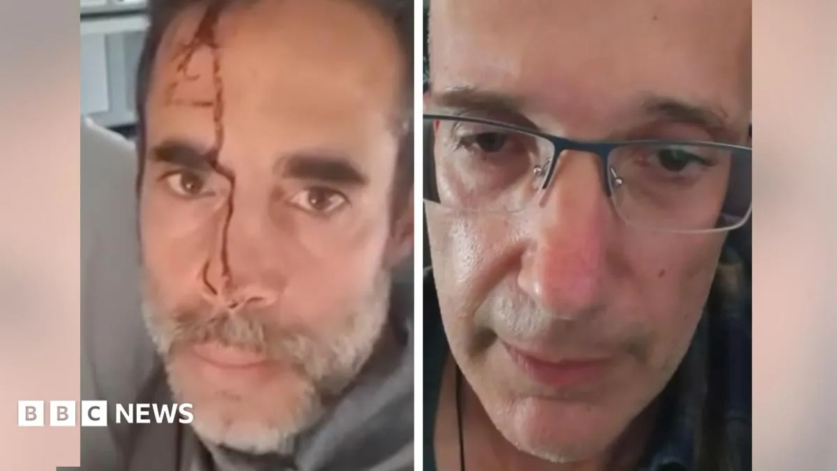 طيار في رحلة دبي-تل أبيب يهاجم زميله ويحاول إسقاط الطائرة
