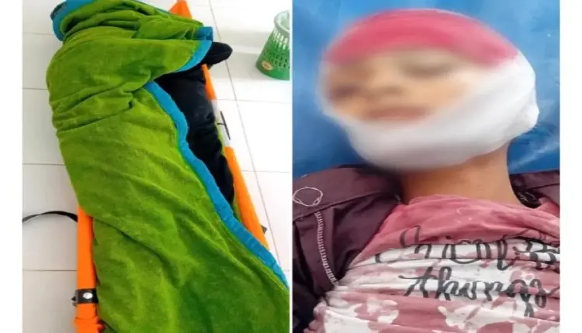 جريمة جديدة للمليشيات..،الحوثي يقتل امرأة وطفل ويصيب 6 مدنيين في شقب تعز