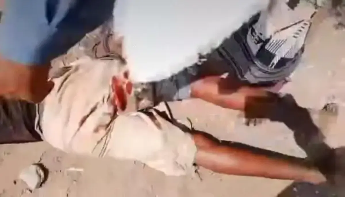 منطق البلطجة والنهب.. قيادي حوثي يصيب مواطناً بثلاث رصاصات لفرض السيطرة على أرضه جنوب الحديدة