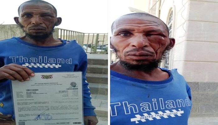 شاهد وحشية الحوثي في ذمار.. اعتداء على مسن أجنبي يهز الرأي العام | صور وتفاصيل