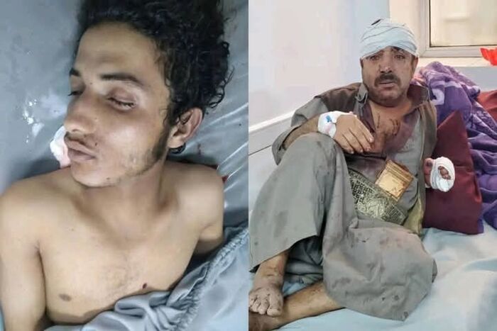 جريمة مروعة تهز صنعاء : مقتل شاب أمام أسرته.. والحوثيون يلتزمون الصمت | تفاصيلها