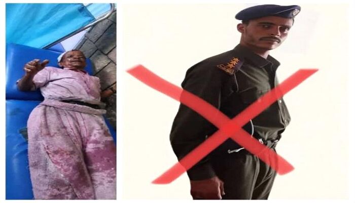 شاهد | جريمة بشعة ومروعة تهز اليمن.. ضابط حوثي يحرق رجل مسن بالزيت المغلي | فيديو وتفاصيل