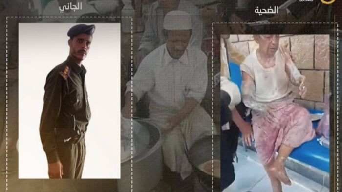 تم حرقه بالزيت المغلي في إب .. أسرة "بائع الزلابيا" تتهم الحوثيين بتمييع الجريمة وترفض التحكيم القبلي