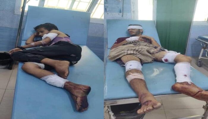سجل الدم | فخ حوثي يحصد ضحاياه: عبوة ناسفة تبتر براءة الطفولة وتصيب شقيقين بجروح خطيرة