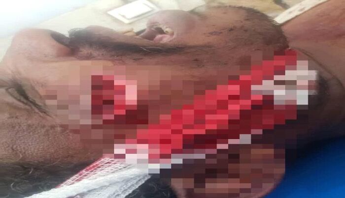 شاهد| "عيب أسود" على الطريقة الصهيونية.. "فيديو" يوثق اعتداء الحوثي على نساء في صالة أعراس بالعاصمة صنعاء