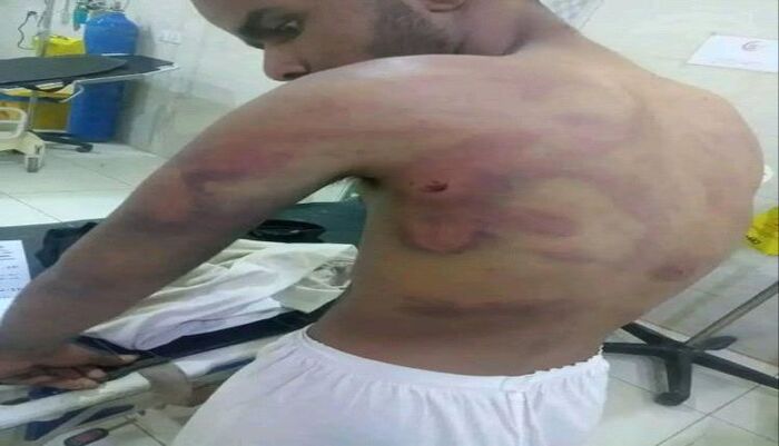 موجة غضب قبلي واسع في مأرب  | شاهد دهس واختطاف وتعذيب.. وادي عبيدة يهتز على وقع جريمة بشعة وسط صمت سلطات المحافظة