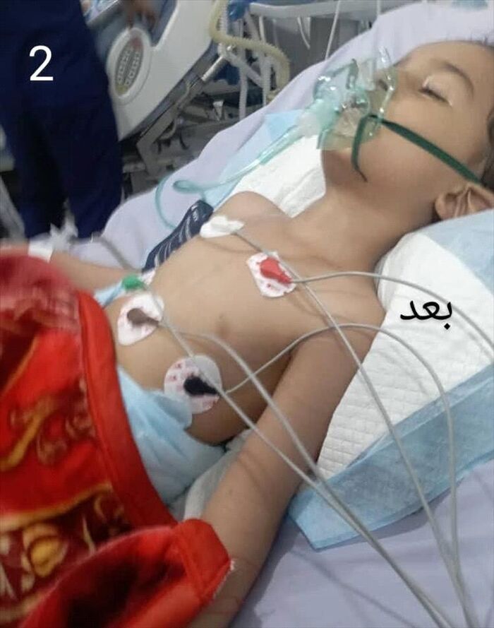 شاهد | كارثة طبية تهز تعز.. جرعة مخدر تدخل الطفل "تيم" في غيبوبة منذ 9 أشهر | صور وتفاصيل