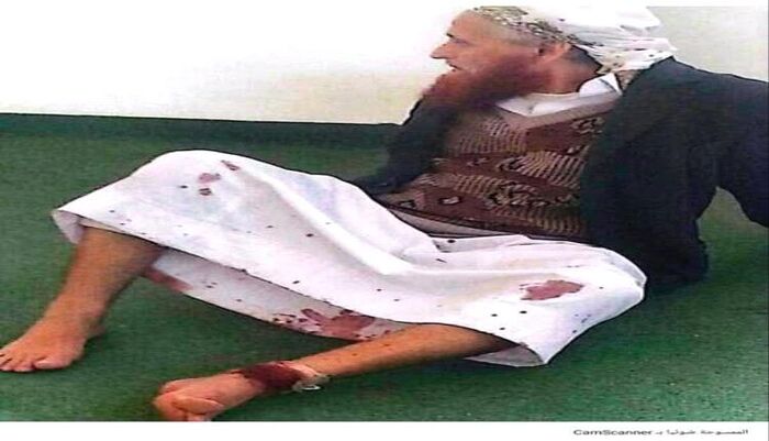 وحشية في استباحت المقدسات والدماء | مسلحون حوثيون يطلقون النار على إمام مسجد مسن داخل بيت الله في ذمار |  اسماء وتفاصيل