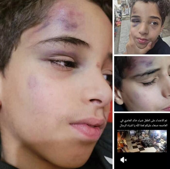 شاهد | عنصران حوثيان يعتديان بوحشية على طفل في سوق مزدحم بصنعاء | فيديو وتفاصيل