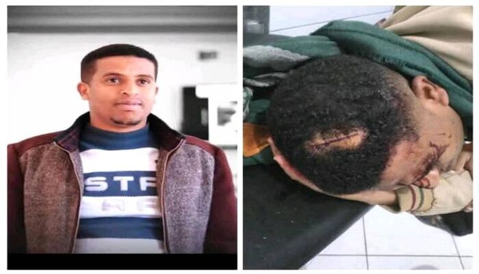 في تعز | اعتداء وحشي على الإعلامي الحمادي بالتربة.. ضرب على الرأس و5 غرز وتهديدات غامضة تلاحقه