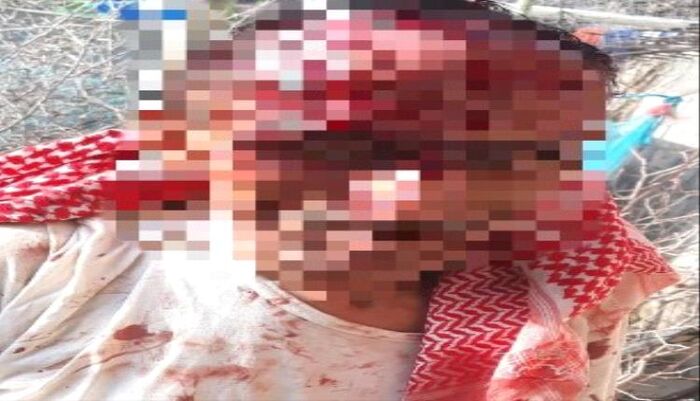 في إب | وحشية حوثية تهز المحافظة .. اعتداء مروّع على طبيب أمام أسرته | تفاصيلها
