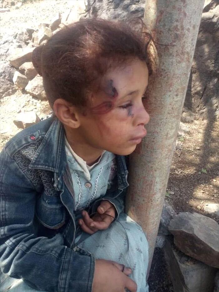 شاهد | وحشيتها تهز تعز.. عمّ يعتدي على طفلة في الـ6 ويحتجزها مع أمها ويمنع إسعافها | صور وتفاصيل