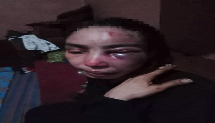 مأساة جديدة واعتداء مروع في تعز | امرأة تُعذب بوحشية على يد طليقها العسكري أمام الناس