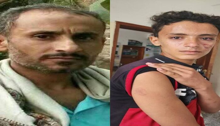 اعتداء مروع في ريمة | مشرف حوثي يُسقط طفل مغشيا عليه ويعتدي بوحشية على والدته بعد محاولتها الدفاع عنه