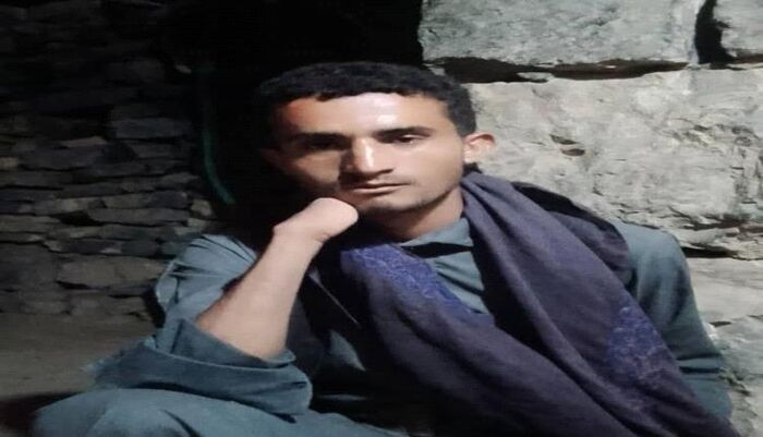 شهادة صادمة | تعذيب مقاتل حوثي فقد ذراعه في الجبهات على يد مدير البحث "المدومي" بتهمة مغازلة بالإنجليزية
