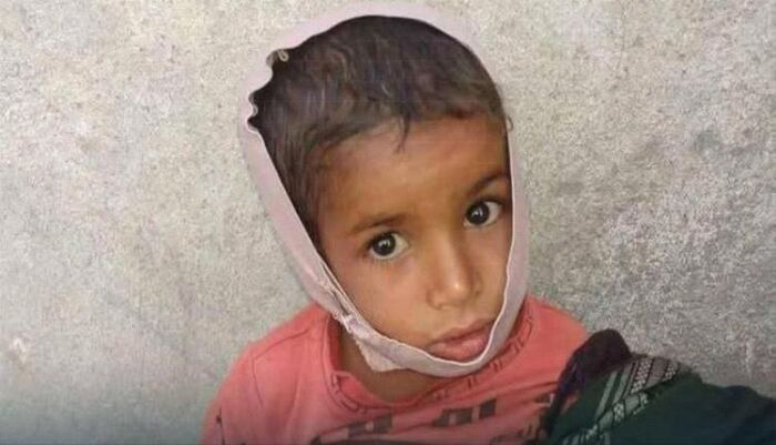 في تعز .. الحوثي تغتال طفولة وجدي بدم بارد بقصف مدفعي عشوائي