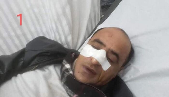 في اليمن | منظمة حقوقية تدين اختطاف مستشار محافظ تعز وتطالب بإطلاقه فورا