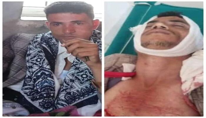 جريمة مروعة | مسلحو الحوثي يصفون بائع قات في نقطة جبايات بالحيمة | اسماء وتفاصيل