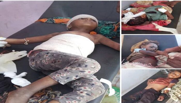 في تعز | الحوثيون يرتكبون جريمة بشعة جديدة .. مقتل وإصابة 4 أطفال بقصف منزل في مقبنة